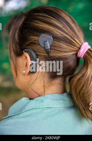 Frauenkopf mit Cochleral-Implantat-Hörgerät Stockfoto