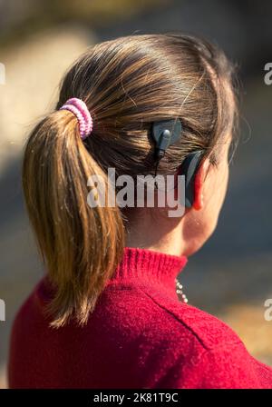Frauenkopf mit Cochleral-Implantat-Hörgerät Stockfoto