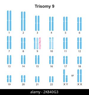 Wissenschaftliche Entwicklung des Karyotyps Trisomie 9. Bunte Symbole. Vektorgrafik. Stock Vektor