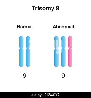 Wissenschaftliche Gestaltung der Trisomie 9. Bunte Symbole. Vektorgrafik. Stock Vektor