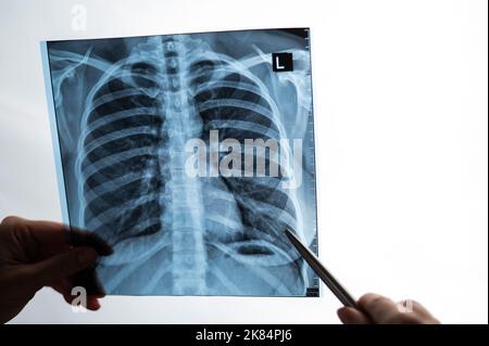 Arzt zeigt Röntgenaufnahme der Lunge des Patienten. Stockfoto