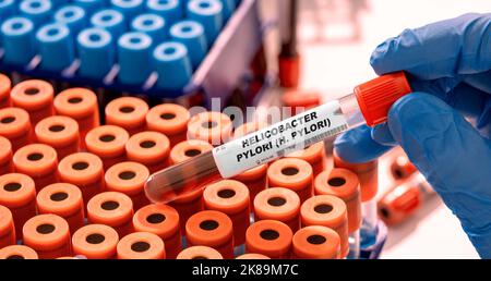 Helicobacter pylori-Bluttest, konzeptuelles Bild Stockfoto