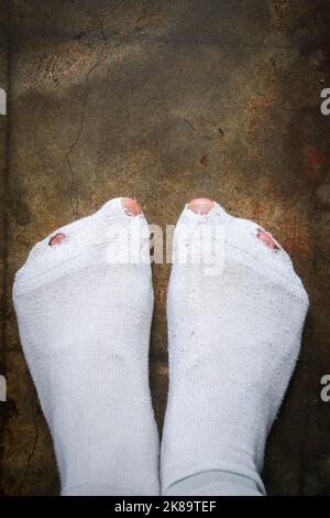 Mann Zehen stochen durch Löcher in weißen Socken, Härtekonzept Stockfoto