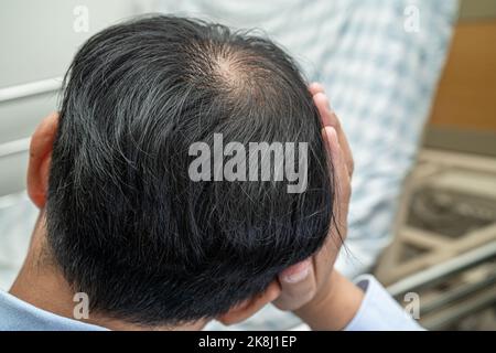 Glatze in der Mitte Kopf und beginnen keinen Verlust Haar glabrous der reifen asiatischen Geschäft smart aktiven Büromann. Stockfoto