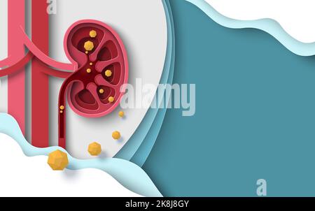Hintergrund des Vektors für Nierensteine bei menschlichen Nierenerkrankungen Stock Vektor