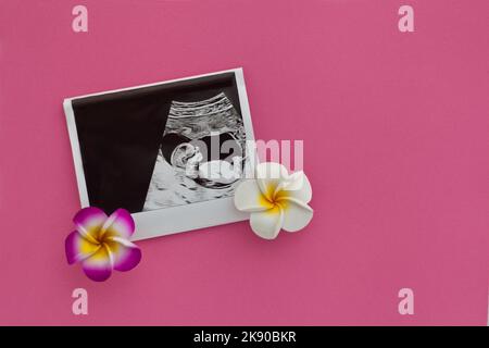 Ultraschall-Babyfoto. Bild bei der Schwangerschaft auf rosa. Konzept der Mutterschaft, Erwartung für die Geburt eines Babys Stockfoto