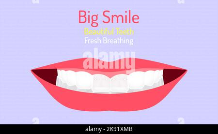 Ein Vektor eines Mundes mit großem Lächeln, schönen Zähnen und frischem Atmen, bearbeitbarer Text Stock Vektor