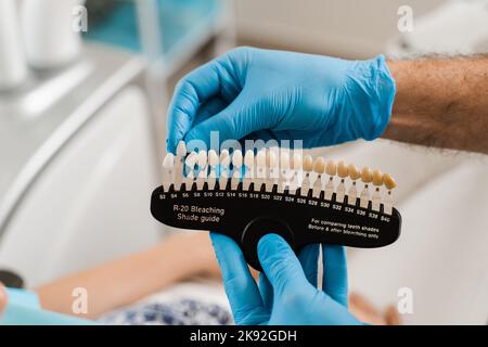 Die Farbtöne der Zähne führen zur Nahaufnahme. Zahnmedizin. Veneers oder Implantate Zähne Farbe passende Proben für Zahnaufhellung für Frau Patientin in der Zahnklinik Stockfoto
