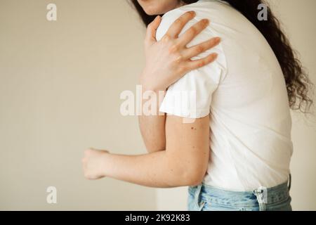 Schulterverletzung. Schönes Mädchen mit Schmerzen und Blutergüssen in ihrem Arm aufgrund eines Unfalls. Traumatologie Stockfoto