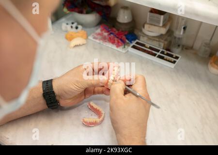 Herstellung von Prothesen. Die Hände des Orthopäden machen Kieferprothesen. Stockfoto