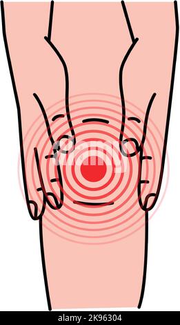 Schmerzen und Verletzungen im menschlichen Knie. Vektorgrafik. Gesundheitliche Probleme bei Muskelschmerzen und Gelenkproblemen. Menschliche Knieschmerzen. Stock Vektor