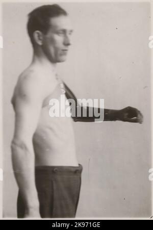 Fotografie aus „ein Bericht über die Herstellung in der Prothesenwerkstatt der Staatsbahn in Nässjö“, 1932. Visces die Fähigkeit der Armprothese zu bewegen und Benutzerfreundlichkeit. Stockfoto