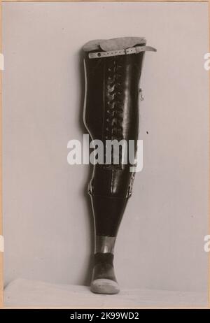 Fotografie aus „ein Bericht über die Herstellung in der Prothesenwerkstatt der Staatsbahn in Nässjö“, 1932. Besucht die Beinprothese mit speziellen Anpassungen für den Patienten. Stockfoto