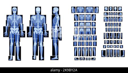 Set Röntgenskelett menschlicher Körper - Hände, Beine, Brust, Köpfe, Wirbel, Becken, Knochen Erwachsene Menschen roentgen Vorderansicht Rückseite. 3D realistische flache blaue Farbe Vektor-Illustration der medizinischen Anatomie Stock Vektor