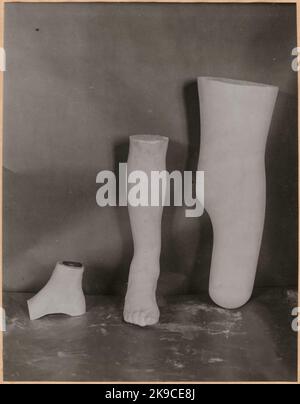 Fotografie aus "einem Bericht über die Herstellung in der Prothesenwerkstatt der Staatsbahn in Nässjö", 1932. Besucht positive Gipsabgüsse von Oberschenkelunterschenkeln und Fotografien, den ersten Teil des Herstellungsverfahrens von Prothesen. Stockfoto