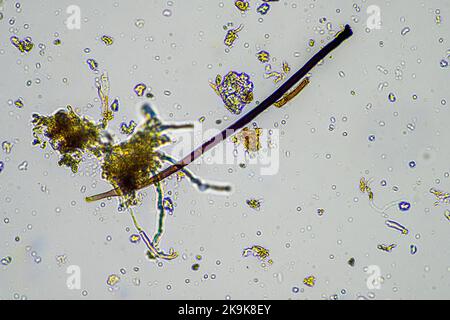 Pilz und Pilzhyphen unter dem Mikroskop im Boden und Kompost, bei