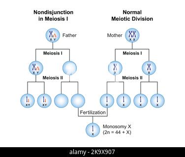 Wissenschaftliche Entwicklung von Nondisjunction bei Monosomie X (Turner-Syndrom) . Bunte Symbole. Vektorgrafik. Stock Vektor