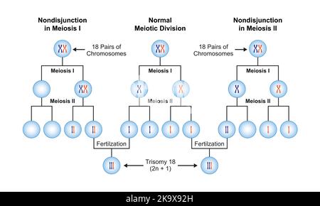 Wissenschaftliche Gestaltung von Nondisjunction in der Trisomie 18. Bunte Symbole. Vektorgrafik. Stock Vektor