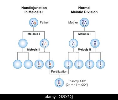 Wissenschaftliche Planung von Nondisjunction bei Trisomie XXY (Klinefelter-Syndrom) . Bunte Symbole. Vektorgrafik. Stock Vektor