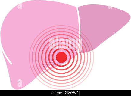 Symbol für menschliche Leberschmerzen. Symbol für Leberschmerzen. Vektorgrafik. Schmerzpunkt des menschlichen Körpers Stock Vektor