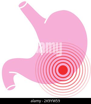 Symbol für menschliche Magenschmerzen. Symbol für Bauchschmerzen. Vektorgrafik. Schmerzpunkt des menschlichen Körpers Stock Vektor