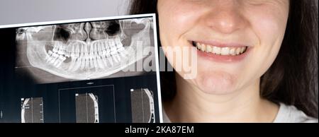 Ein Patient mit einer Fehlfunktion, fehlendem Kauzahn und einer Funktionsstörung des Kiefergelenks hält seinen CT-Scan des Kiefers fest. Stockfoto