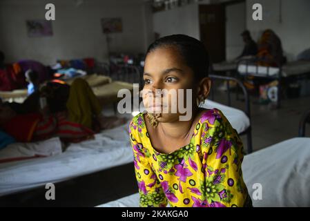 Auf diesem Foto, das am 30. Januar 2017 aufgenommen wurde, posiert der 10-Jahre-Patient aus Bangladesch, Sahana Khatun, für ein Foto am Dhaka Medical College and Hospital. Ein junges Mädchen aus Bangladesch mit rindenähnlichen Warzen, die auf ihrem Gesicht wachsen, könnte die erste Frau sein, die jemals von einem so genannten „Baum-Mann-Syndrom“ betroffen war, sagten Ärzte, die die seltene Erkrankung studierten, im Januar 31. Die zehnjährige Sahana Khatun hat die erzählenden knarrigen Wucherungen, die aus ihrem Kinn, Ohr und ihrer Nase sprießen, aber die Ärzte im Krankenhaus der Medizinischen Hochschule von Dhaka führen immer noch Tests durch, um festzustellen, ob sie an der ungewöhnlichen Hautkrankheit leidet. (Foto von Mamunur Rashid/NurP Stockfoto