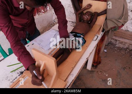 MOGADISCHU, SOMALIA - 25. MÄRZ 2017 - das Zentrum ist voll mit Müttern, die Schlange stehen, um die Erdnusspaste zu erhalten, und Kindern, die gewogen und gescreent werden. (Foto von Maciej Moskwa/NurPhoto) *** Bitte nutzen Sie die Gutschrift aus dem Kreditfeld *** Stockfoto