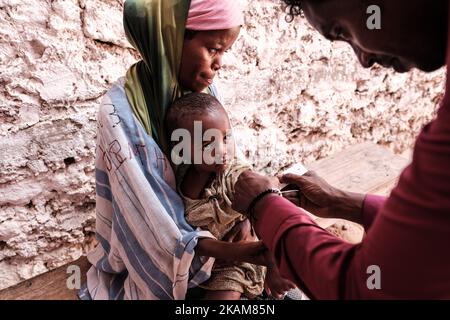 MOGADISCHU, SOMALIA - 25. MÄRZ 2017 - das Zentrum ist voll mit Müttern, die Schlange stehen, um die Erdnusspaste zu erhalten, und Kindern, die gewogen und gescreent werden. (Foto von Maciej Moskwa/NurPhoto) *** Bitte nutzen Sie die Gutschrift aus dem Kreditfeld *** Stockfoto