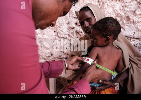 MOGADISCHU, SOMALIA - 25. MÄRZ 2017 - das Zentrum ist voll mit Müttern, die Schlange stehen, um die Erdnusspaste zu erhalten, und Kindern, die gewogen und gescreent werden. (Foto von Maciej Moskwa/NurPhoto) *** Bitte nutzen Sie die Gutschrift aus dem Kreditfeld *** Stockfoto