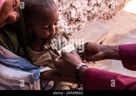 MOGADISCHU, SOMALIA - 25. MÄRZ 2017 - das Zentrum ist voll mit Müttern, die Schlange stehen, um die Erdnusspaste zu erhalten, und Kindern, die gewogen und gescreent werden. (Foto von Maciej Moskwa/NurPhoto) *** Bitte nutzen Sie die Gutschrift aus dem Kreditfeld *** Stockfoto