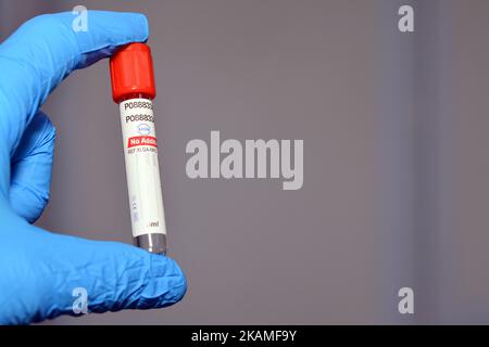 Kairo, Ägypten, Oktober 22 2022: Blutentnahmeröhrchen zur Entnahme von Blutproben für Laboranalysetests wie CBC Complete Blood Count, ESR, CR Stockfoto