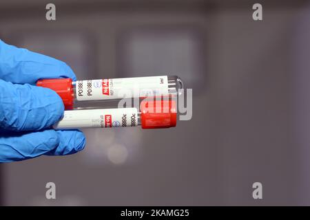 Kairo, Ägypten, Oktober 22 2022: Blutentnahmeröhrchen zur Entnahme von Blutproben für Laboranalysetests wie CBC Complete Blood Count, ESR, CR Stockfoto