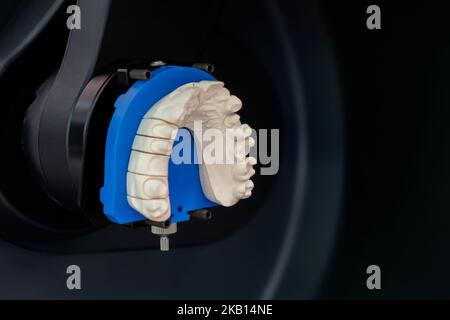 3D-Dental-Scanner für das Scannen und Messen von Gipsmodellen - Nahaufnahme Stockfoto