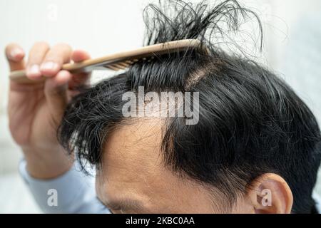 Glatze in der Mitte Kopf und beginnen keinen Verlust Haar glabrous der reifen asiatischen Geschäft smart aktiven Büromann. Stockfoto