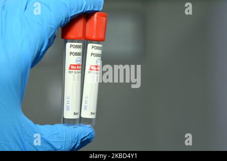 Kairo, Ägypten, Oktober 22 2022: Blutentnahmeröhrchen zur Entnahme von Blutproben für Laboranalysetests wie CBC Complete Blood Count, ESR, CR Stockfoto