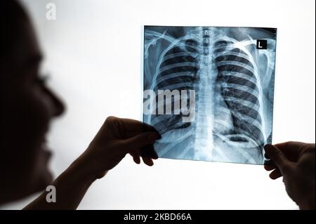 Arzt zeigt Röntgenaufnahme der Lunge des Patienten. Stockfoto