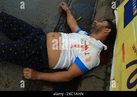 (HINWEIS DER REDAKTION: Das Bild enthält grafische Inhalte.) Ein Straßenunfall von Männern am 7,2020. Oktober in Kalkutta schwer verletzt (Foto: Debajyoti Chakraborty/NurPhoto) Stockfoto