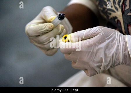 Ein Mitarbeiter im Gesundheitswesen nimmt eine Blutprobe von einer Person für die serologische Erhebungsrunde 4. auf Coronavirus, die am 15. Oktober 2020 in einer Apotheke in Daryaganj in Neu-Delhi, Indien, durchgeführt wurde. Die Übung hilft der Verabreichung, Trends zu analysieren und Konzepte und Strategien zur Eindämmung der Infektion zu formulieren. (Foto von Mayank Makhija/NurPhoto) Stockfoto