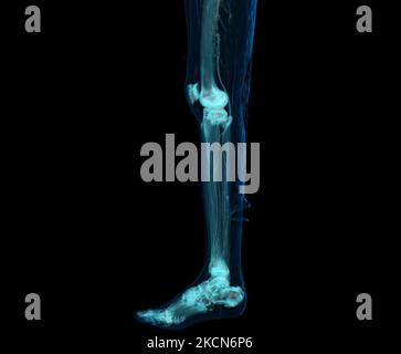 3D Render der unteren Extremität oder Beine isoliert auf schwarzem Hintergrund. Stockfoto