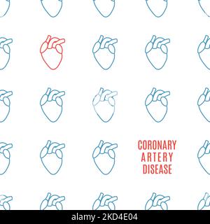 Koronare Herzkrankheit, konzeptuelle Illustration Stockfoto