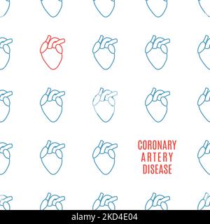 Koronare Herzkrankheit, konzeptuelle Illustration Stockfoto