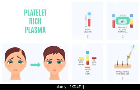 PRP Haarausfall Behandlung, konzeptionelle Illustration Stockfoto