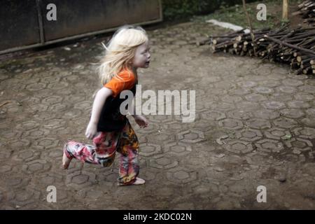 Jajang Gunawan (6), einer der Nachkommen Albinos, spielte am 9. Juni 2022 mit seinen Freunden im Dorf Ciburuy, Bezirk Garut, Provinz West-Java. (Foto von Aditya Irawan/NurPhoto) Stockfoto