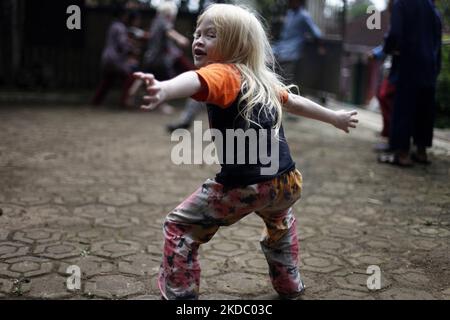 Jajang Gunawan (6), einer der Nachkommen Albinos, spielte am 9. Juni 2022 mit seinen Freunden im Dorf Ciburuy, Bezirk Garut, Provinz West-Java. (Foto von Aditya Irawan/NurPhoto) Stockfoto