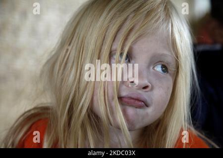 Jajang Gunawan (6), einer der Nachkommen Albinos, spielte am 9. Juni 2022 mit seinen Freunden im Dorf Ciburuy, Bezirk Garut, Provinz West-Java. (Foto von Aditya Irawan/NurPhoto) Stockfoto