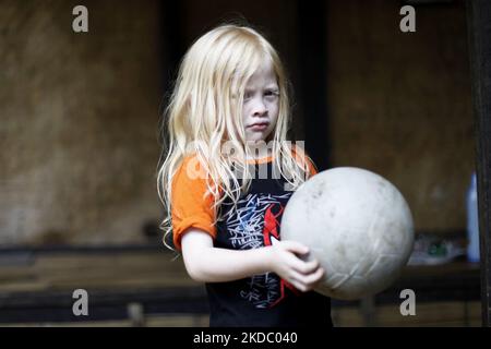 Jajang Gunawan (6), einer der Nachkommen Albinos, spielte am 9. Juni 2022 mit seinen Freunden im Dorf Ciburuy, Bezirk Garut, Provinz West-Java. (Foto von Aditya Irawan/NurPhoto) Stockfoto