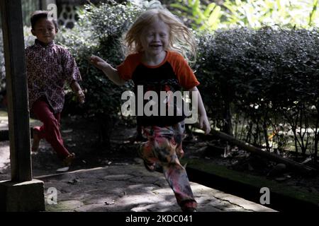 Jajang Gunawan (6), einer der Nachkommen Albinos, spielte am 9. Juni 2022 mit seinen Freunden im Dorf Ciburuy, Bezirk Garut, Provinz West-Java. (Foto von Aditya Irawan/NurPhoto) Stockfoto