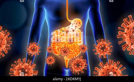 Gastroenteritis der Magengrippe 3D Darstellung mit roten Viruszellen und menschlichen Körper. Virale, infektiöse und entzündliche Magen- oder Gastrointe Stockfoto