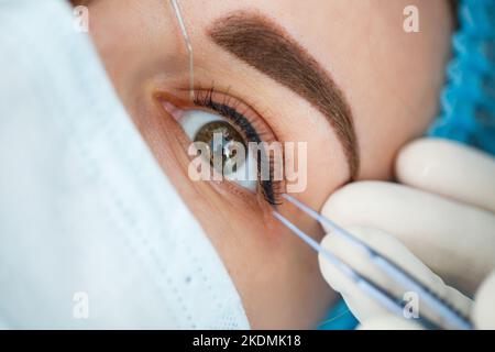 Medizinische Laser-Augenkorrektur. Medizintechnik Augenoperation. Stockfoto